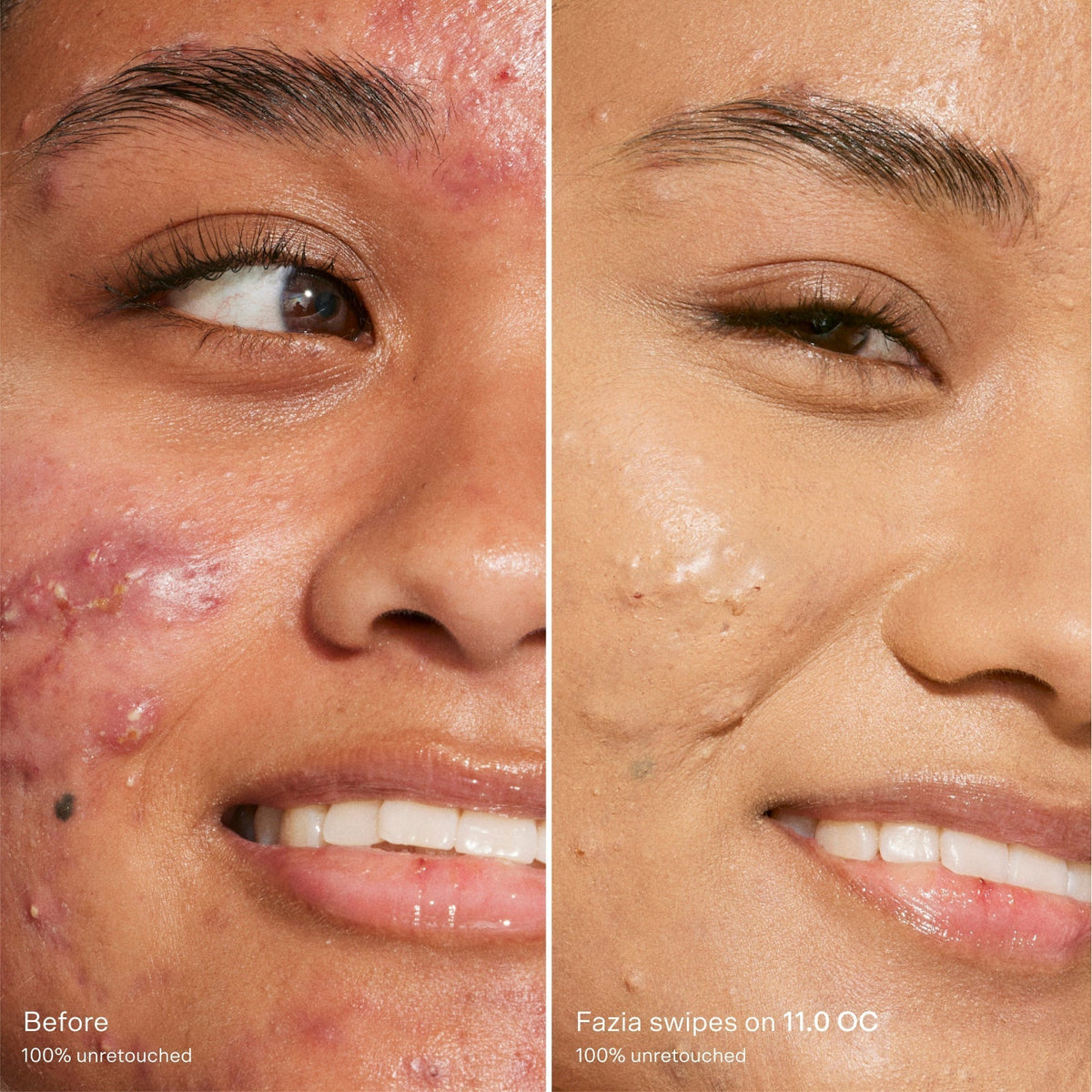 Swipe Serum Concealer® Q9