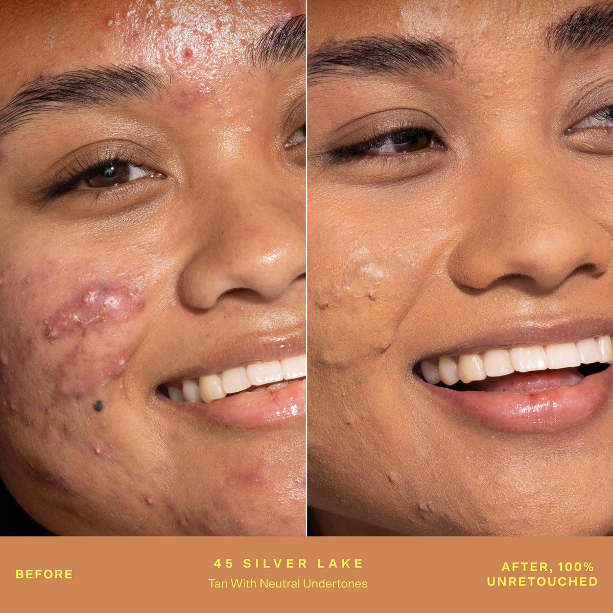 SunnyDays™ Tinted SPF 30 A2