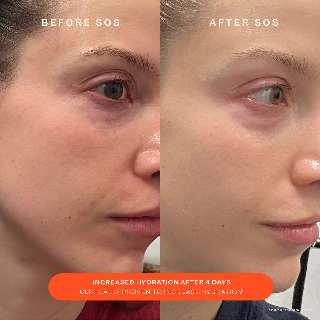 SOS Recovery Cream C2