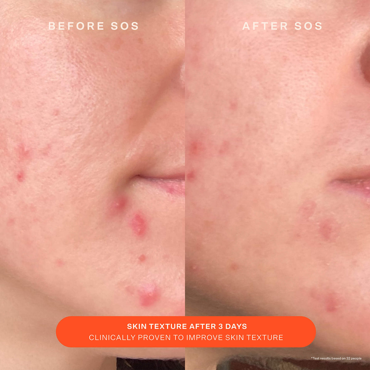 SOS Recovery Cream C2