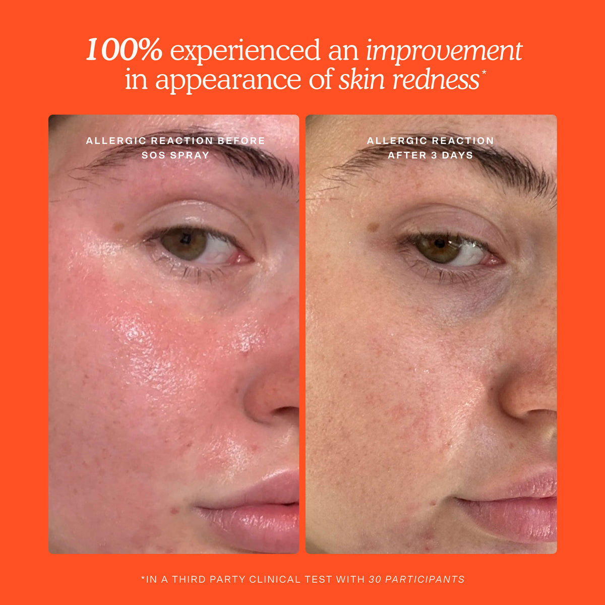 SOS Skincare Minis Kit Y0