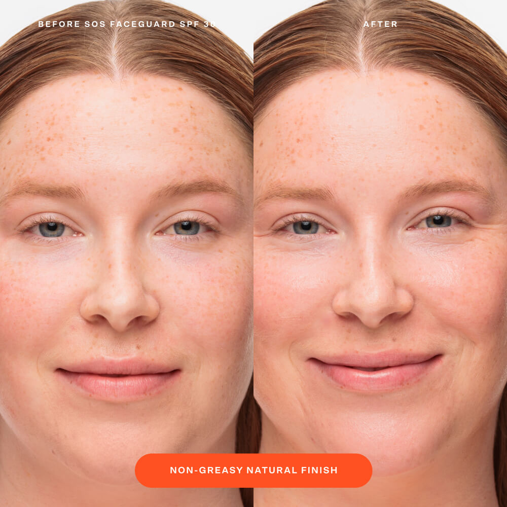 SOS FaceGuard™ SPF 30 Sunscreen PA+++ P7