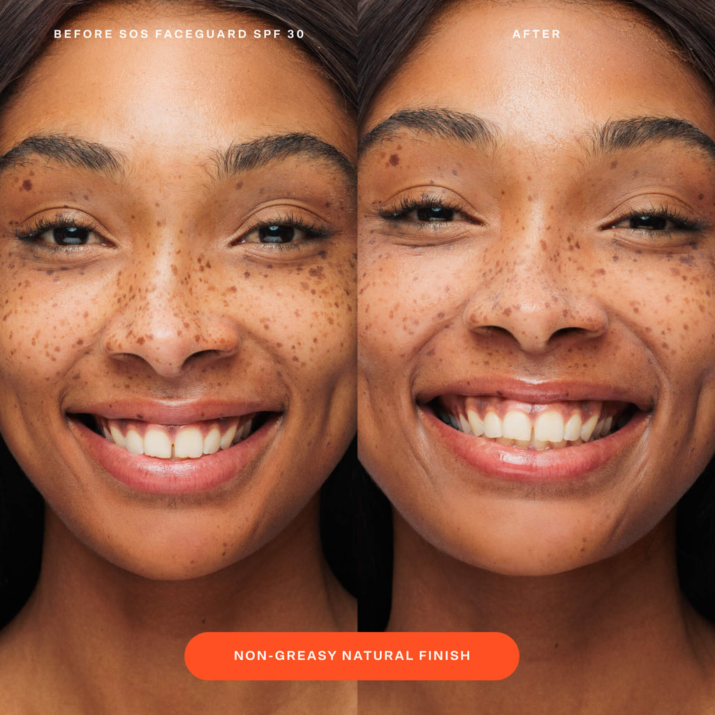 SOS FaceGuard™ SPF 30 Sunscreen PA+++ D9