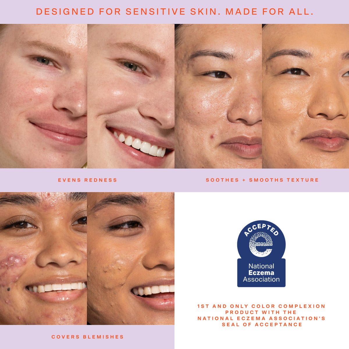 SunnyDays™ Tinted SPF 30 A2